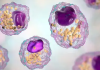Exosome-Based Strategies for Cancer Treatment